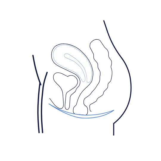 Fisioterapia Suelo Pélvico Viten