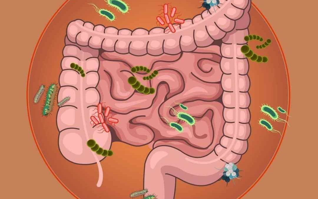 El SIBO, la posible respuesta a la inflamación abdominal