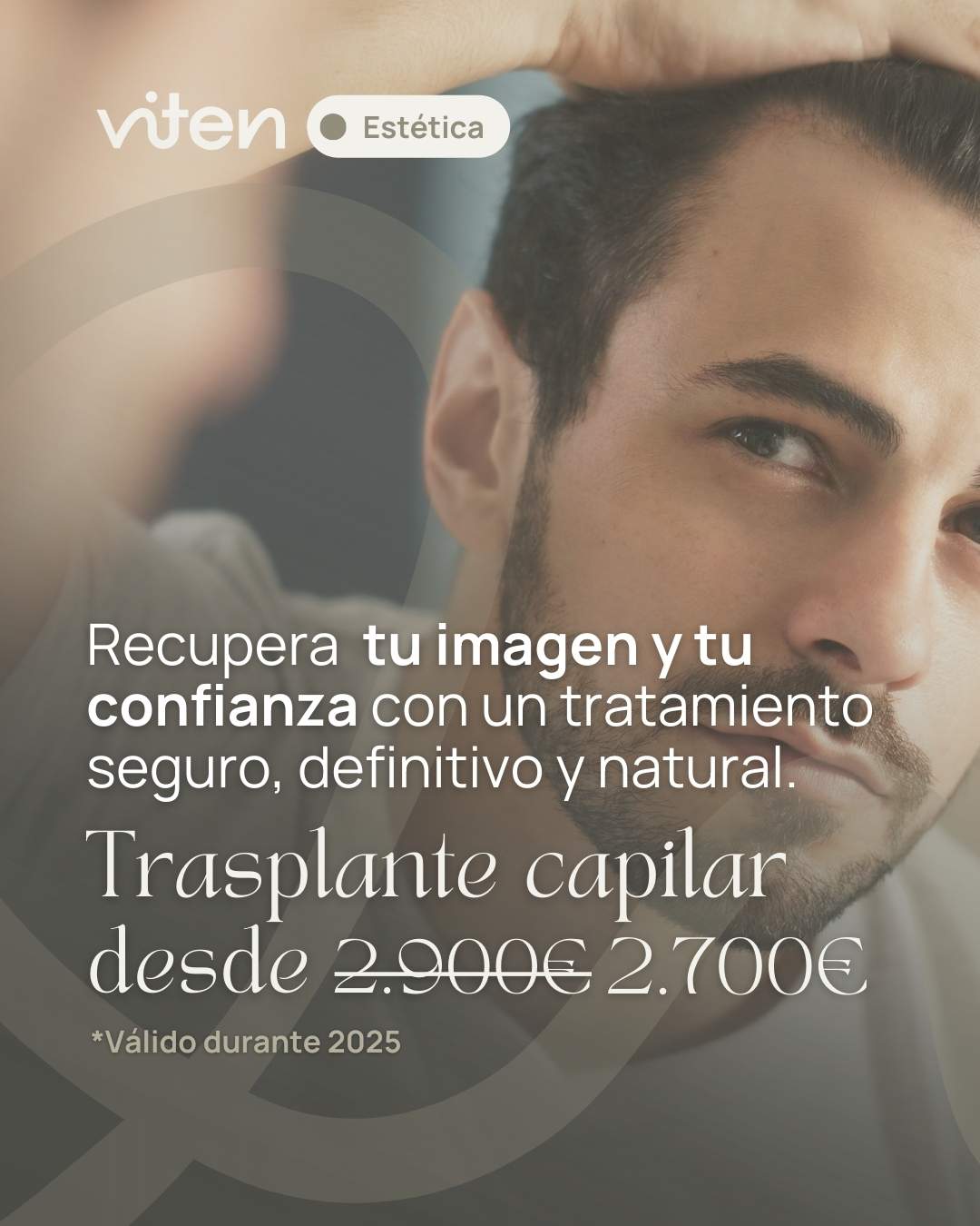 Trasplante capilar