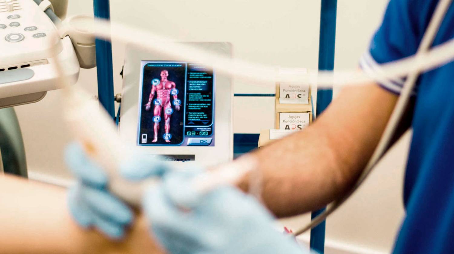 Fisioterapia Invasiva Viten