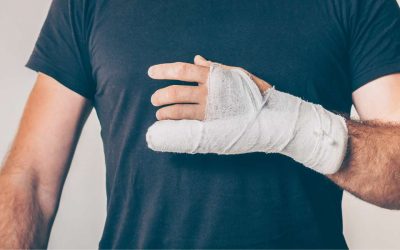 Fracturas óseas: Mecanismo de lesión, tiempos de recuperación y tratamientos