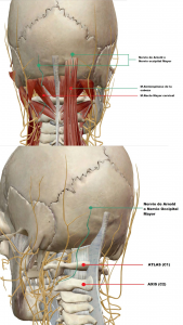 Cefalea por neuralgia de Arnold