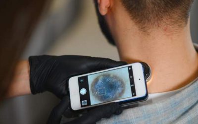 Dermatología en Vélez-Málaga | Diagnóstico en 48h | Viten