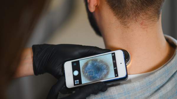 Tele dermatología Vélez-Málaga