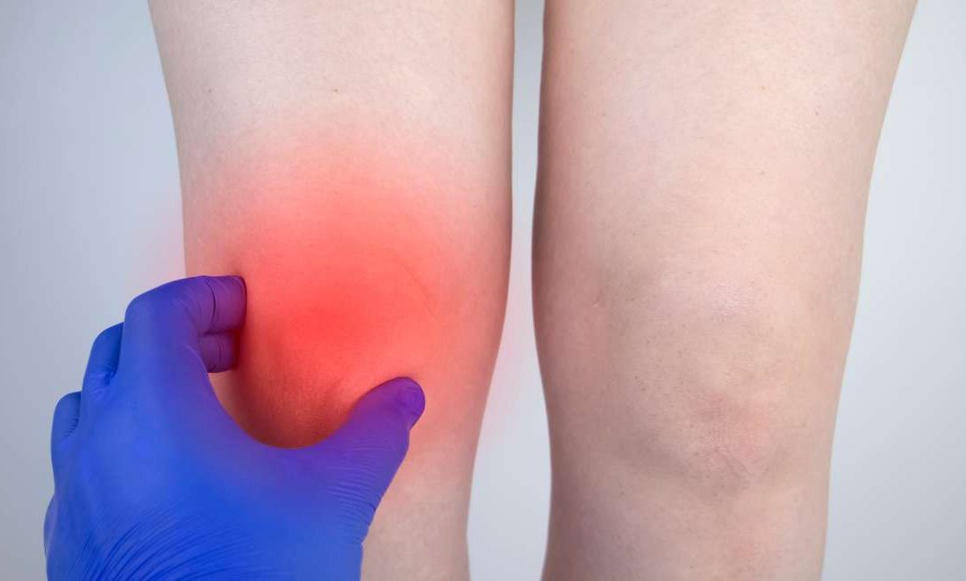 Edema Óseo, qué es y cómo tratarlo