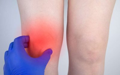 Edema Óseo, qué es y cómo tratarlo