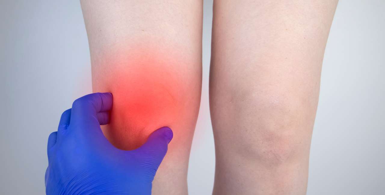 Edema óseo que es y como tratarlo