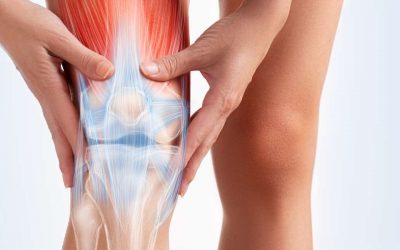Esguinces de Rodilla: Prevención y tratamiento en fisioterapia