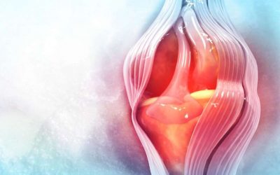 Meniscopatías, qué son y cómo se tratan