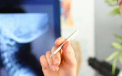 Neuralgia cervicobraquial: causas, prevención y tratamientos