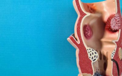 Síndrome genitourinario de la menopausia