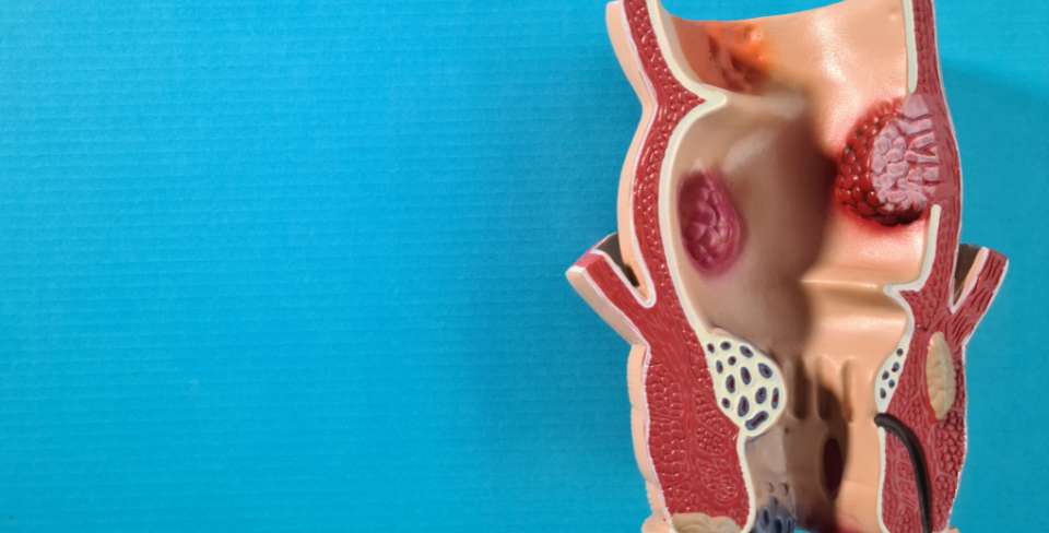 síndrome genitourinario suelo pélvico