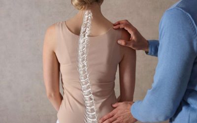 Escoliosis, cómo corregirla con redcord