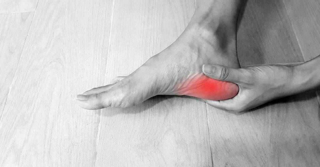 fascitis plantar