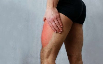 Meralgia Parestésica qué es y como se trata