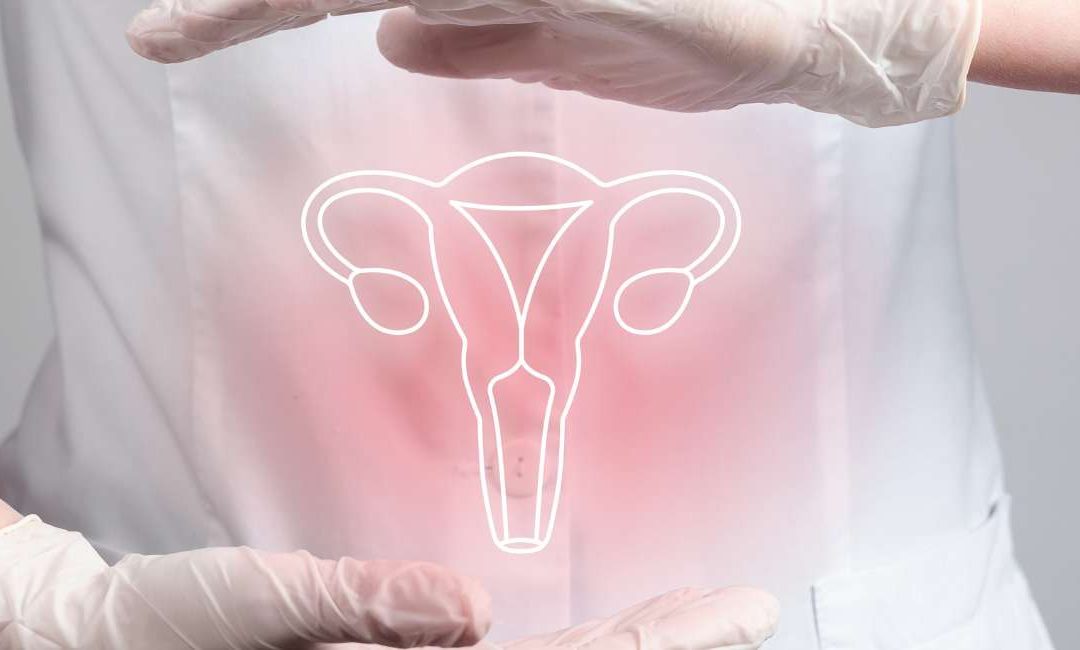 Endometriosis: Una Visión Integral