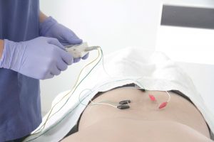 neuromodulación subcutánea