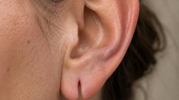 Lobuloplastia Málaga