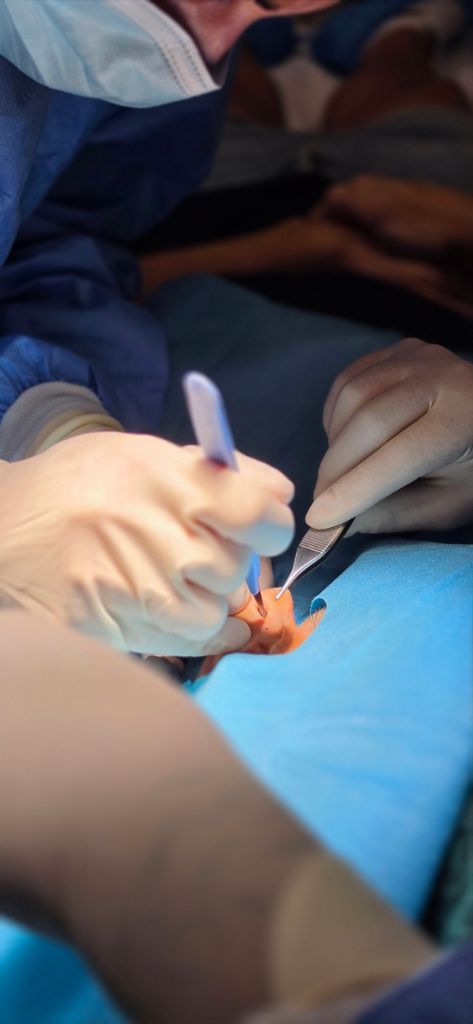 Lobuloplastia operación cirugía