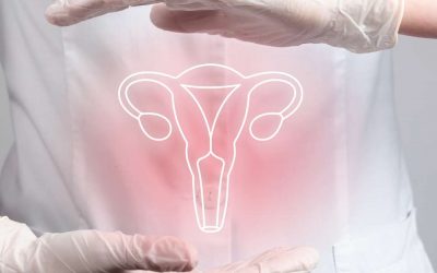 Endometriosis: Una Visión Integral